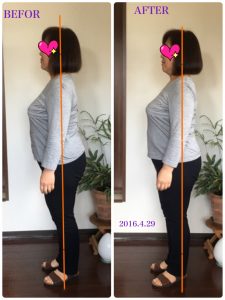 リンパケアBEFOR&AFTER