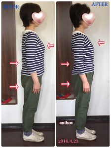 リンパケアBEFOR&AFTER