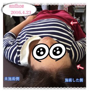 リンパケア バストアップ