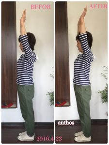 リンパケアBEFOR&AFTER