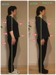 2016.5.10BEFOR&AFTER