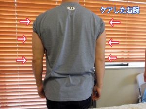 セルフケア症例