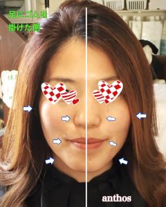 輪ゴムBEFOR&AFTER