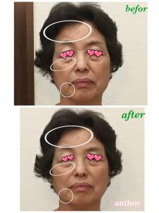 ブラシケアで若返り