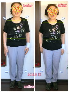 リンパケア症例