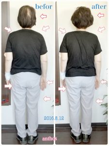 リンパケア症例