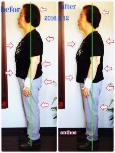 リンパケア症例