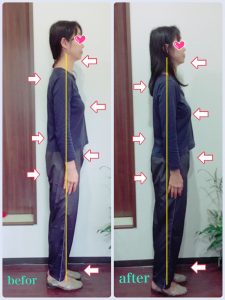 リンパケア症例