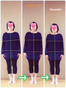 セルフケア症例