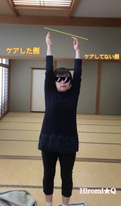 セルフケア症例